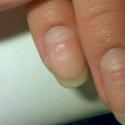 Защо ноктите ми са оребрени: какво да правя с това?